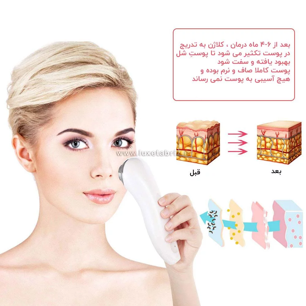 دستگاه مینی هایفو کلین سالنی 