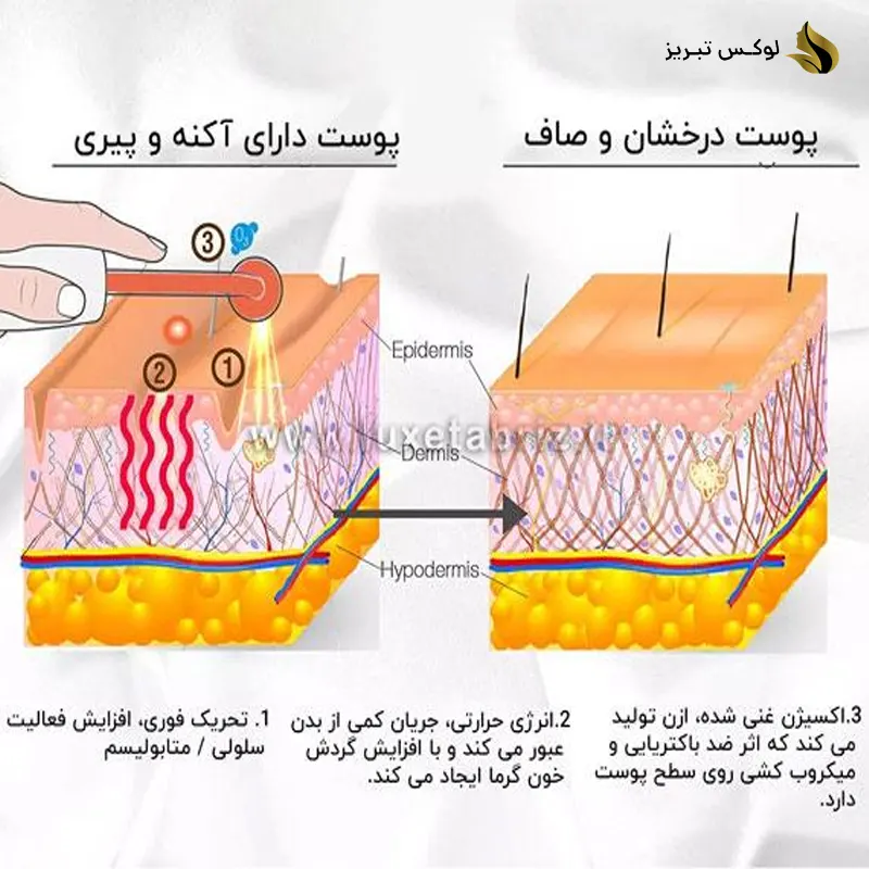 شیوه کارکرد دستگاه هایفرکوئنسی پرتابل