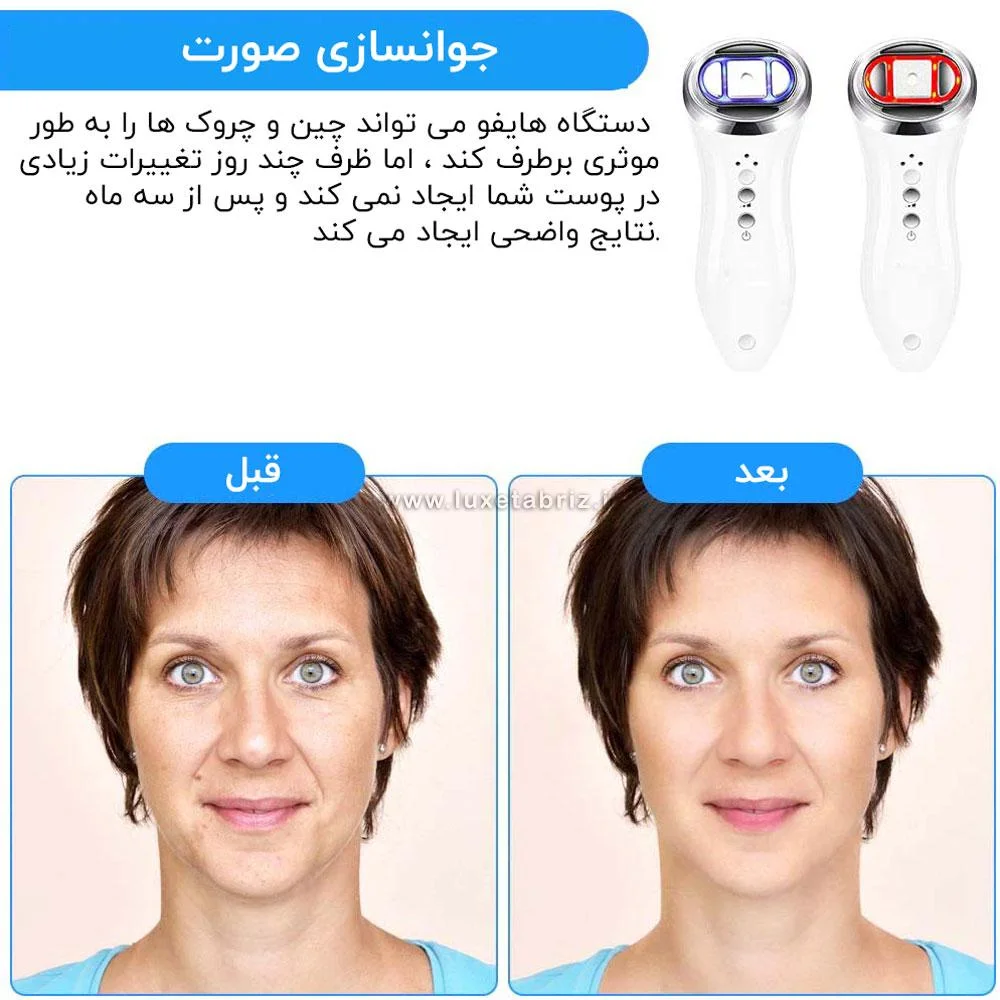دستگاه هایفو خانگی