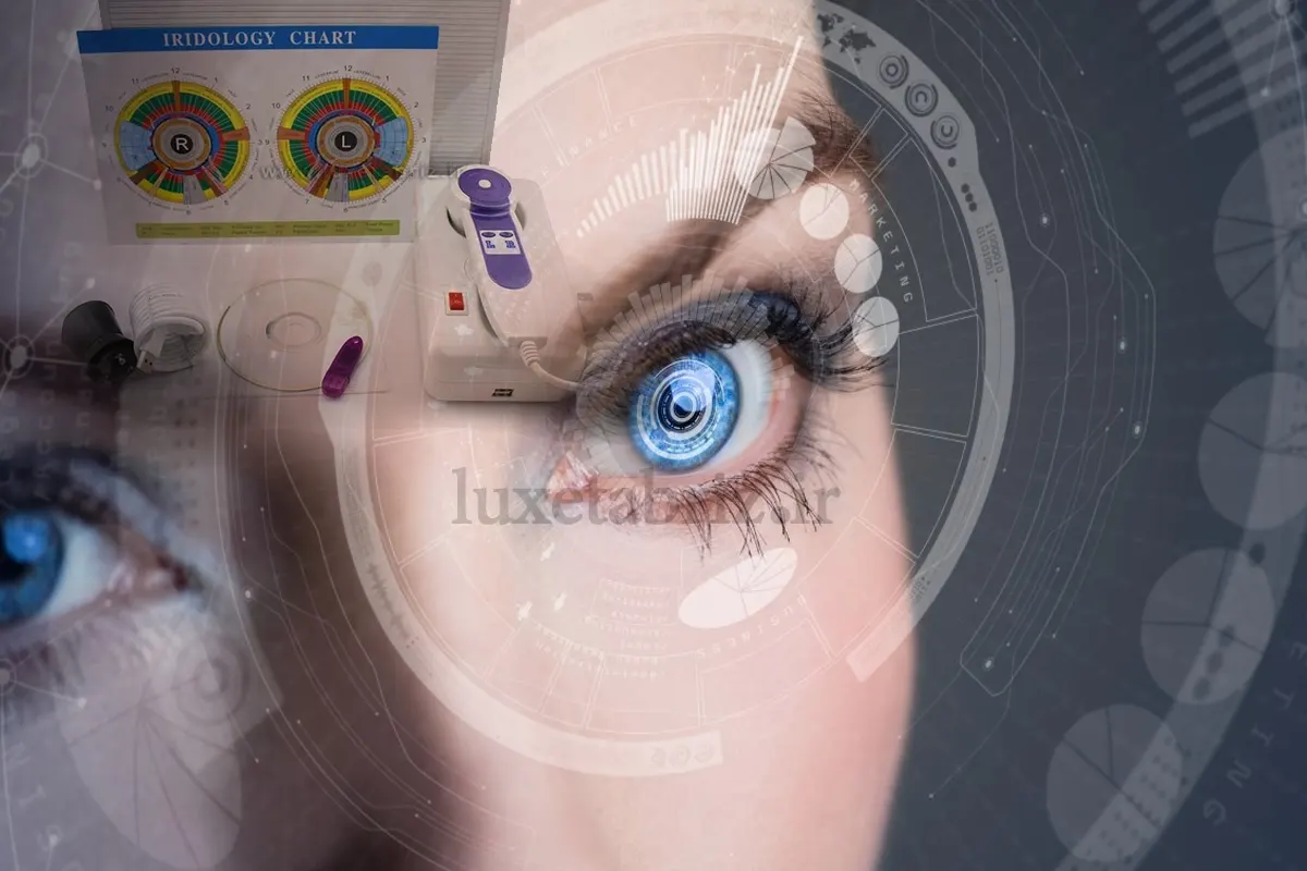 چارت عنبیه شناسی همراه با تفسیر کامل