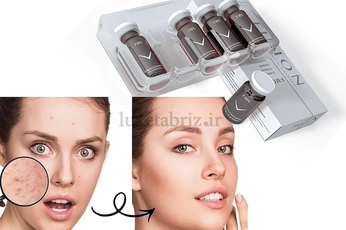 مزایا و ویژگی فیوژن اصل